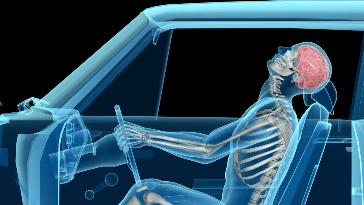 Whiplash and Massage Therapy: A Foundational Overview